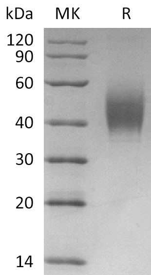 Cynomolgus CD226 +SDS-PAGE.jpg